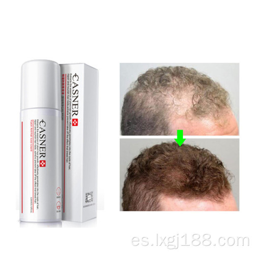 spray de crecimiento rápido de cabello orgánico 100% natural